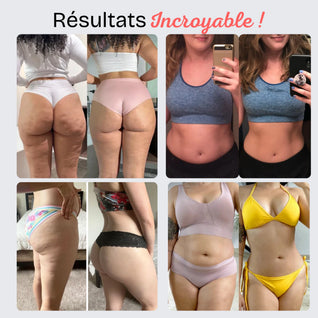 CelluCore™ | Legging anti-cellulite, jambes lissées