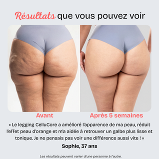 CelluCore™ | Legging anti-cellulite, jambes lissées